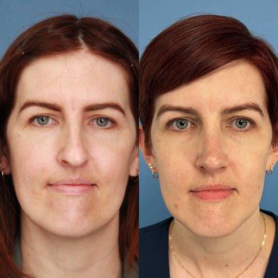 lv plastic surgery reviews